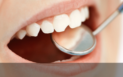 Traumatismo Dentário