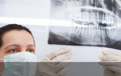 Radiografia