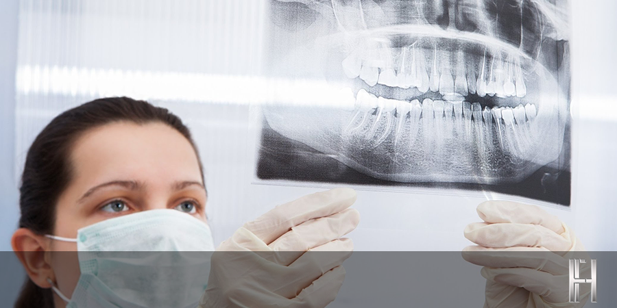 Radiografia