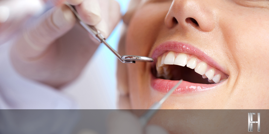 Tratamento de Canal (Endodontia)
